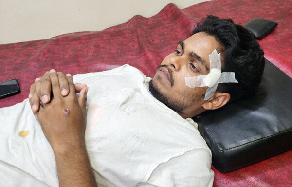 রাবিতে ছাত্রদল নেতার ছুরিকাঘাতের শিক্ষার্থী আহত
