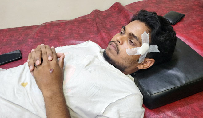 রাবিতে ছাত্রদল নেতার ছুরিকাঘাতের শিক্ষার্থী আহত