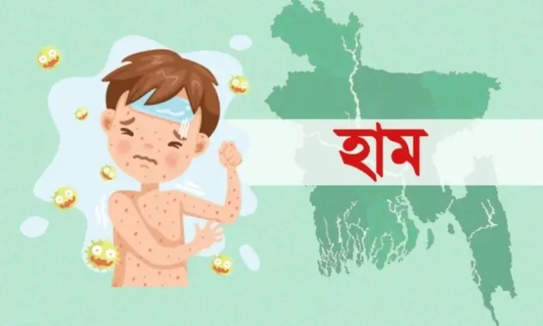 হামের বিষয় তদন্তে দেশি-বিদেশি বিশেষজ্ঞ কমিটি হবে: ডা. জাহেদ উর রহমান