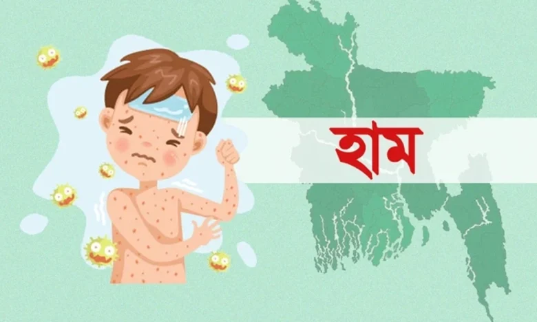হামের বিষয় তদন্তে দেশি-বিদেশি বিশেষজ্ঞ কমিটি হবে: ডা. জাহেদ উর রহমান