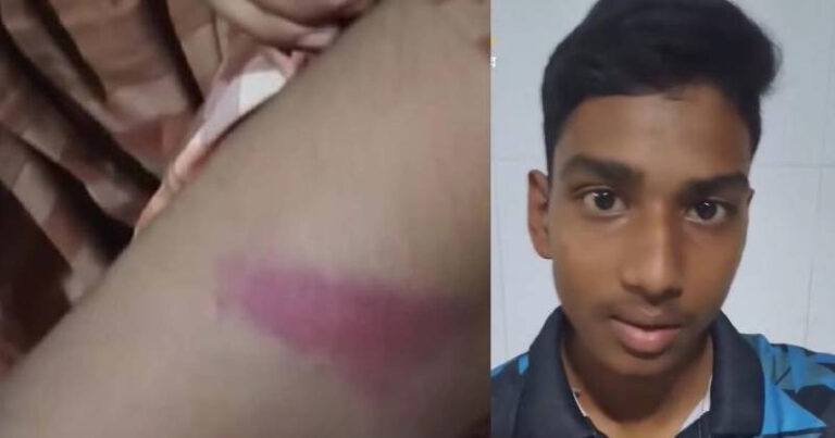 তানোরে জুয়া খেলা দেখে ফেলায় স্কুলছাত্রকে মারধর