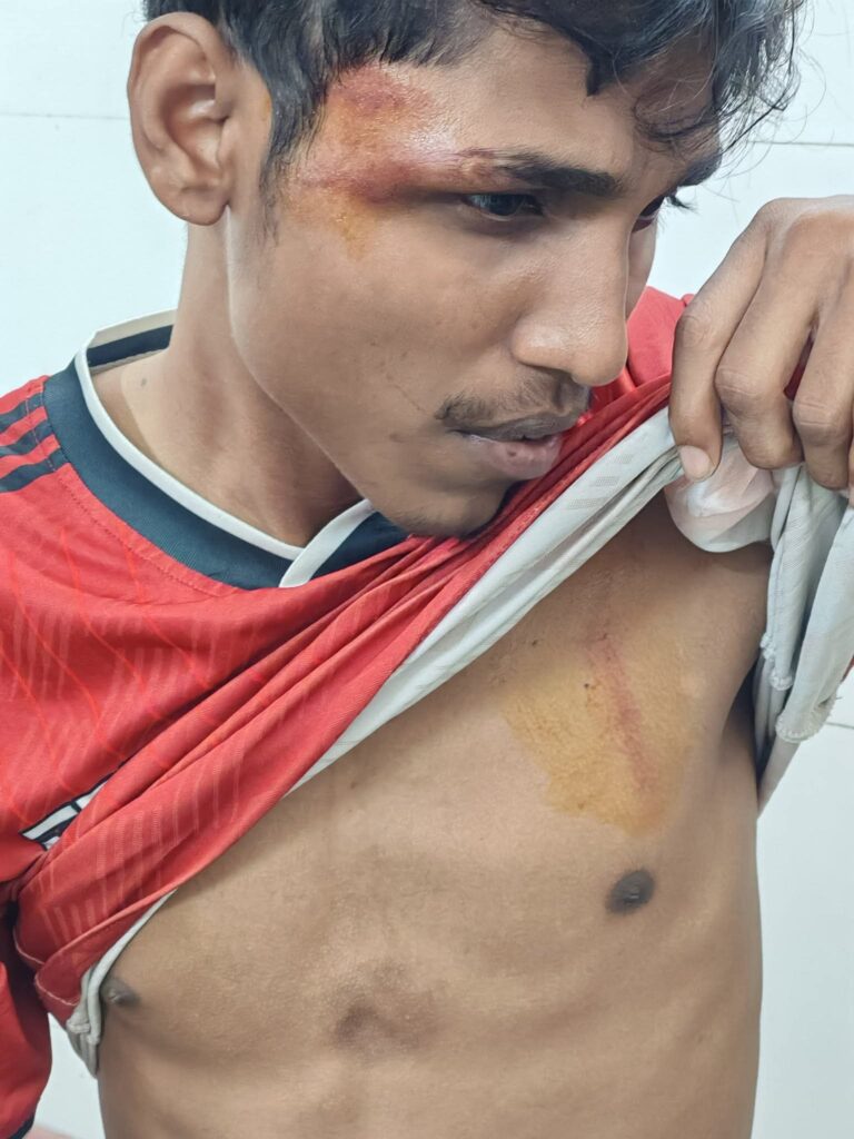 রেলস্টেশনে শিক্ষার্থীকে মারধরের বর্ণনা দিলেন শিক্ষার্থী আসিফ